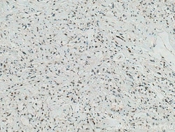 IFI16 Mouse Monoclonal Antibody, Proteintech Unconjugated; 20 &mu;L:Antibodies,