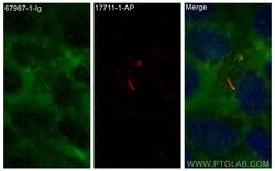 IFT81 Mouse Monoclonal Antibody, Proteintech 150 &mu;L | Buy Online | Proteintech | Fisher Scientific