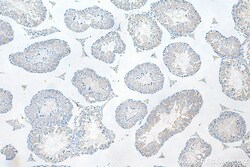 IFT81 Mouse Monoclonal Antibody, Proteintech 150 &mu;L | Buy Online | Proteintech | Fisher Scientific