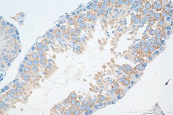 IFT81 Mouse Monoclonal Antibody, Proteintech 150 &mu;L | Buy Online | Proteintech | Fisher Scientific