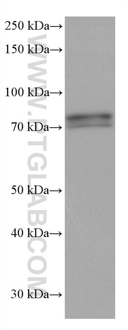 IFT81 Mouse Monoclonal Antibody, Proteintech 150 &mu;L | Buy Online | Proteintech | Fisher Scientific