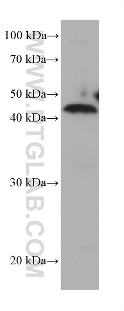 IGFBP3 Mouse Monoclonal Antibody, Proteintech:Antibodies:Primary Antibodies