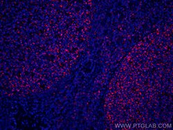 IL-19 Mouse anti-Human, CoraLite 594, Clone: 8H10H8, Proteintech 20 &mu;L;