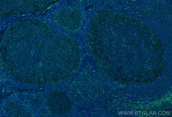 CoraLite Plus 488-conjugated IL-4RA/CD124 Mouse Monoclonal Antibody, Proteintech 20 &mu;L | Buy Online | Proteintech | Fisher Scientific
