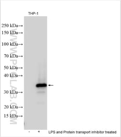 IL-1 beta Rabbit Polyclonal Antibody, Proteintech Unconjugated; 20 &mu;L:Antibodies,