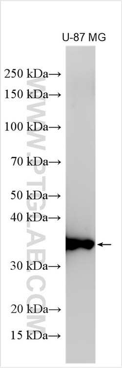 IL-1 beta Rabbit Polyclonal Antibody, Proteintech Unconjugated; 20 &mu;L:Antibodies,