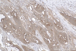 gp130/IL6ST Mouse Monoclonal Antibody, Proteintech Unconjugated; 150 &mu;L:Antibodies,