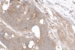 gp130/IL6ST Mouse Monoclonal Antibody, Proteintech Unconjugated; 150 &mu;L:Antibodies,