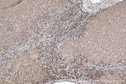 gp130/IL6ST Mouse Monoclonal Antibody, Proteintech Unconjugated; 150 &mu;L:Antibodies,