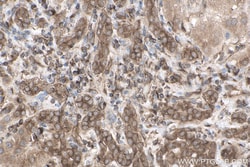 gp130/IL6ST Mouse Monoclonal Antibody, Proteintech Unconjugated; 150 &mu;L:Antibodies,