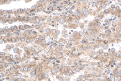 gp130/IL6ST Mouse Monoclonal Antibody, Proteintech Unconjugated; 150 &mu;L:Antibodies,