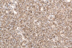 gp130/IL6ST Mouse Monoclonal Antibody, Proteintech Unconjugated; 150 &mu;L:Antibodies,