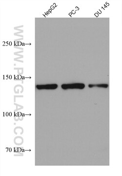 gp130/IL6ST Mouse Monoclonal Antibody, Proteintech Unconjugated; 150 &mu;L:Antibodies,