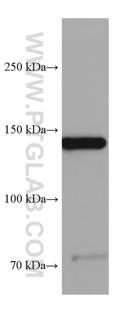 gp130/IL6ST Mouse Monoclonal Antibody, Proteintech Unconjugated; 150 &mu;L:Antibodies,