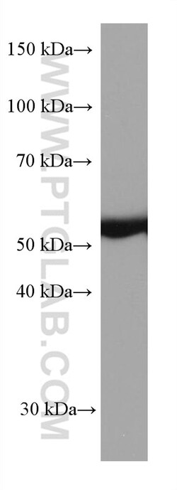 ILK Mouse Monoclonal Antibody, Proteintech Unconjugated; 20 &mu;L:Antibodies,