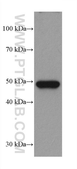 ILK Mouse Monoclonal Antibody, Proteintech Unconjugated; 20 &mu;L:Antibodies,