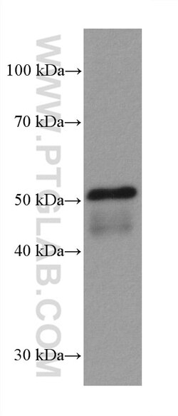 ILK Mouse Monoclonal Antibody, Proteintech Unconjugated; 20 &mu;L:Antibodies,