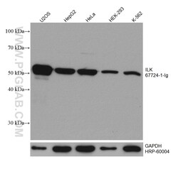 ILK Mouse Monoclonal Antibody, Proteintech Unconjugated; 20 &mu;L:Antibodies,