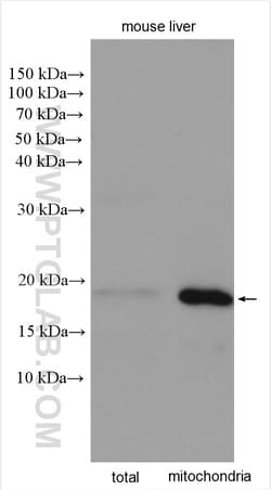 IMMP1L Rabbit Polyclonal Antibody, Proteintech Unconjugated; 20 &mu;L:Antibodies,