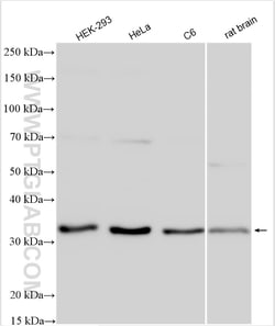 ING4 Rabbit Polyclonal Antibody, Proteintech Unconjugated; 20 &mu;L:Antibodies,
