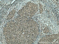 ING4 Mouse Monoclonal Antibody, Proteintech Unconjugated; 20 &mu;L:Antibodies,