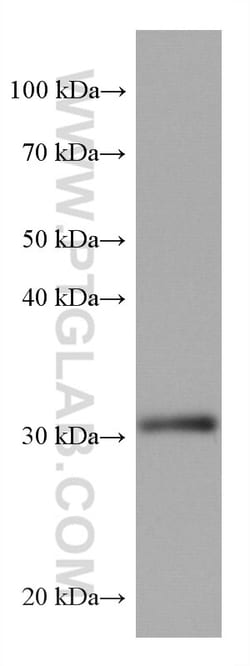 ING4 Mouse Monoclonal Antibody, Proteintech Unconjugated; 20 &mu;L:Antibodies,