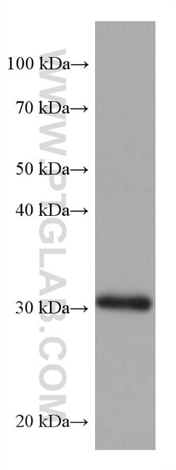 ING4 Mouse Monoclonal Antibody, Proteintech Unconjugated; 20 &mu;L:Antibodies,