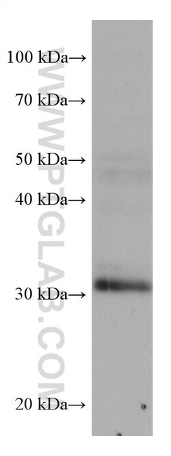 ING4 Mouse Monoclonal Antibody, Proteintech Unconjugated; 20 &mu;L:Antibodies,