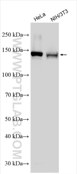 INPPL1 Rabbit Polyclonal Antibody, Proteintech Unconjugated; 20 &mu;L:Antibodies,