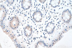 IRF3 Rabbit Recombinant Antibody, Proteintech Unconjugated; 100 &mu;L:Antibodies,