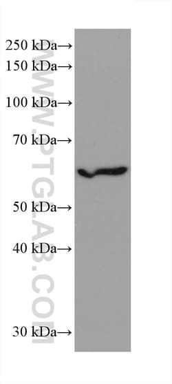 IRF3 Rabbit Recombinant Antibody, Proteintech Unconjugated; 100 &mu;L:Antibodies,