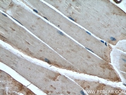 IRS2 Rabbit Polyclonal Antibody, Proteintech Unconjugated; 20 &mu;L:Antibodies,