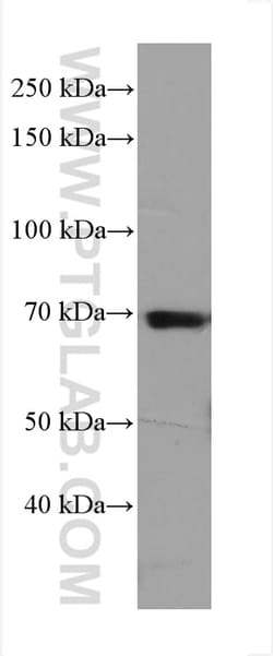 ITK Mouse Monoclonal Antibody, Proteintech Unconjugated; 20 &mu;L:Antibodies,