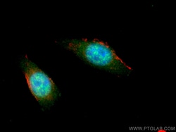 Importin Alpha 5 Mouse Monoclonal Antibody, Proteintech:Antibodies:Primary