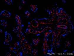 Integrin alpha 1 Rabbit Polyclonal Antibody, Proteintech:Antibodies:Primary