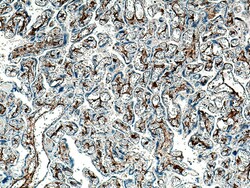 Integrin alpha 1 Rabbit Polyclonal Antibody, Proteintech:Antibodies:Primary