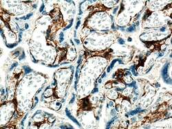 Integrin alpha 1 Rabbit Polyclonal Antibody, Proteintech:Antibodies:Primary