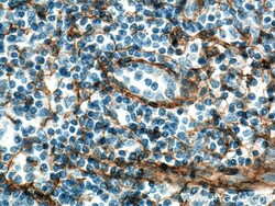 Integrin alpha 1 Rabbit Polyclonal Antibody, Proteintech:Antibodies:Primary