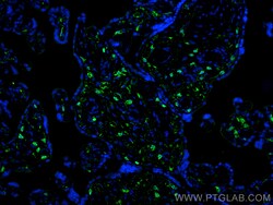 Integrin alpha 1 Mouse Monoclonal Antibody, Proteintech:Antibodies:Primary