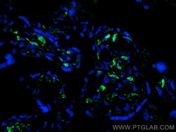 Integrin alpha 1 Mouse Monoclonal Antibody, Proteintech:Antibodies:Primary