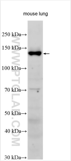 Integrin alpha-8 Rabbit Polyclonal Antibody, Proteintech:Antibodies:Primary