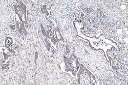 Integrin Beta 5 Rabbit Polyclonal Antibody, Proteintech:Antibodies:Primary