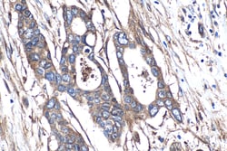 Integrin Beta 5 Rabbit Polyclonal Antibody, Proteintech:Antibodies:Primary