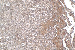 Integrin Beta 5 Rabbit Polyclonal Antibody, Proteintech:Antibodies:Primary