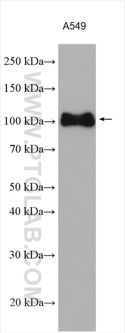 Integrin Beta 5 Rabbit Polyclonal Antibody, Proteintech:Antibodies:Primary