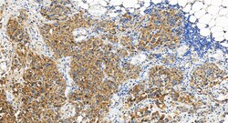 Integrin beta-8 Rabbit Polyclonal Antibody, Proteintech:Antibodies:Primary