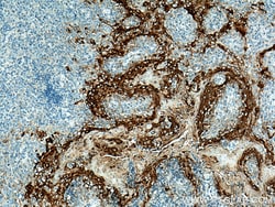 Involucrin Rabbit Polyclonal Antibody, Proteintech:Antibodies:Primary Antibodies
