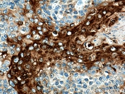 Involucrin Rabbit Polyclonal Antibody, Proteintech:Antibodies:Primary Antibodies