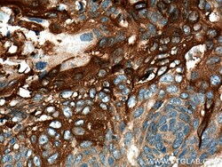 Involucrin Rabbit Polyclonal Antibody, Proteintech:Antibodies:Primary Antibodies