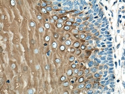 Involucrin Rabbit Polyclonal Antibody, Proteintech:Antibodies:Primary Antibodies